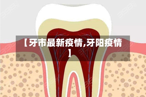 【牙市最新疫情,牙阳疫情】-第3张图片
